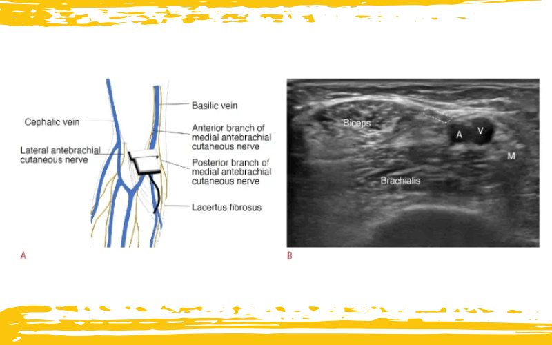 1. Diagnostico diferencial codo nervio cubital 1.png